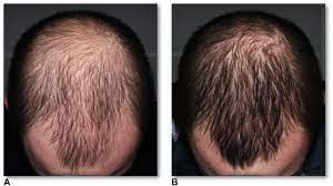 Biotin + Dexpanthenol