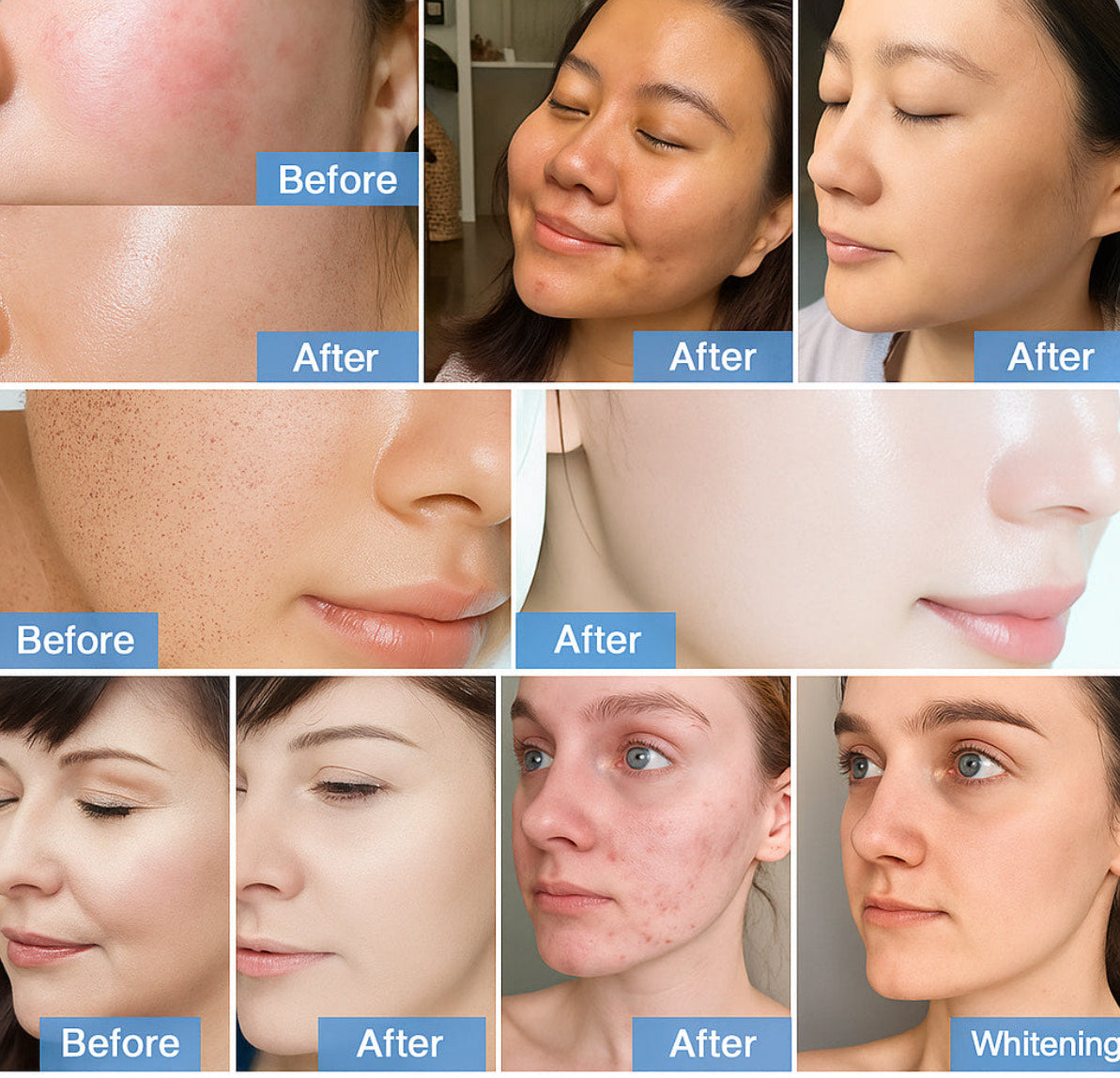 Classic Glow Facial +  LED Light Therapy