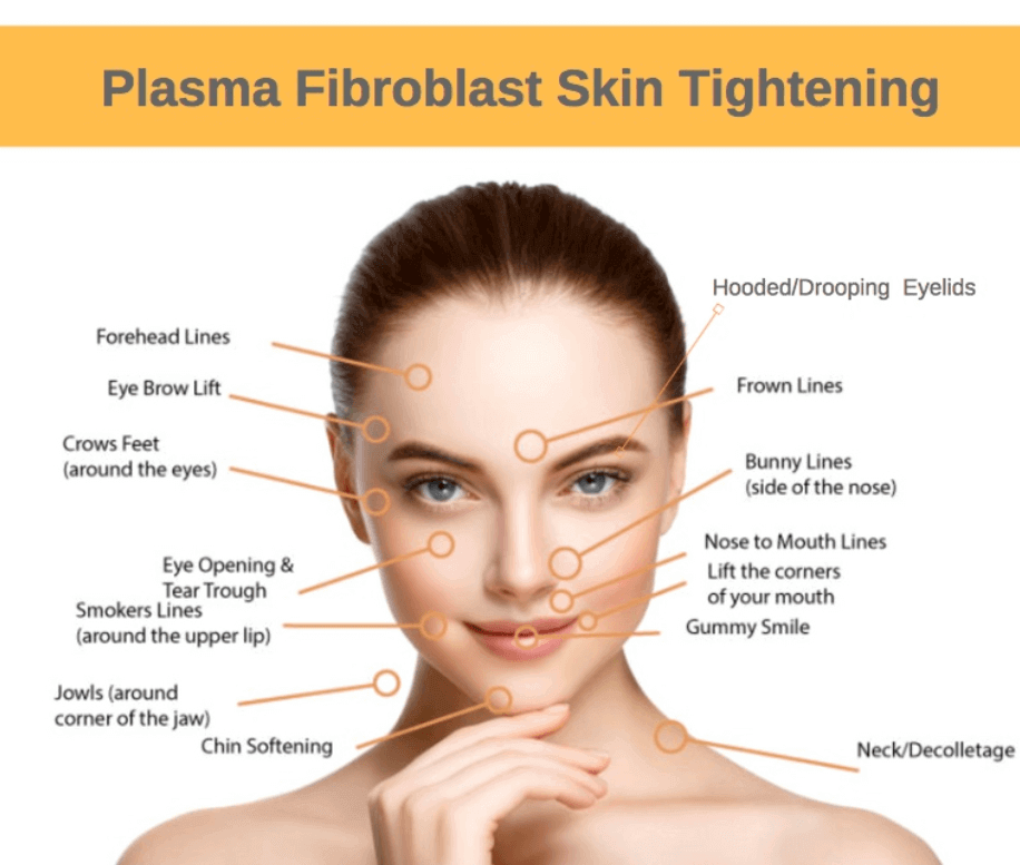 Plasma Fibroblast Skin Tightening Treatment